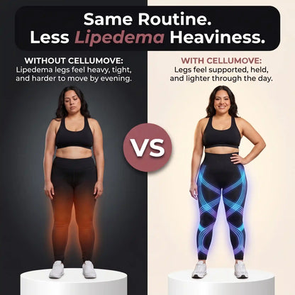 Cellumove USA 3D Legging – Say goodbye to lipoedema pain and swelling naturally.